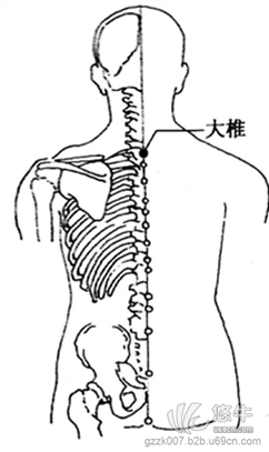 针灸推拿培训班图1